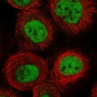 Immunofluorescent staining of human cell line A-431 shows localization to nucleoplasm.