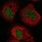 Anti-BTBD8 Antibody