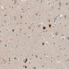 Anti-MXI1 Antibody