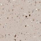 Anti-MXI1 Antibody