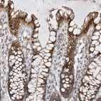 Immunohistochemical staining of human colon shows moderate to strong nuclear positivity in glandular cells.