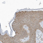 Anti-MXI1 Antibody