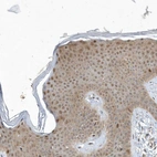 Immunohistochemical staining of human skin shows moderate to strong nuclear positivity in epidermal cells.
