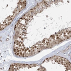 Immunohistochemical staining of human testis shows moderate to strong nuclear positivity in cells in seminiferous ducts.