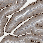 Immunohistochemical staining of human fallopian tube shows high expression.