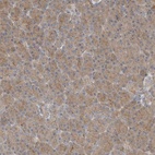 Immunohistochemical staining of human pancreas shows low expression as expected.