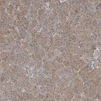 Immunohistochemical staining of human pancreas shows low expression as expected.