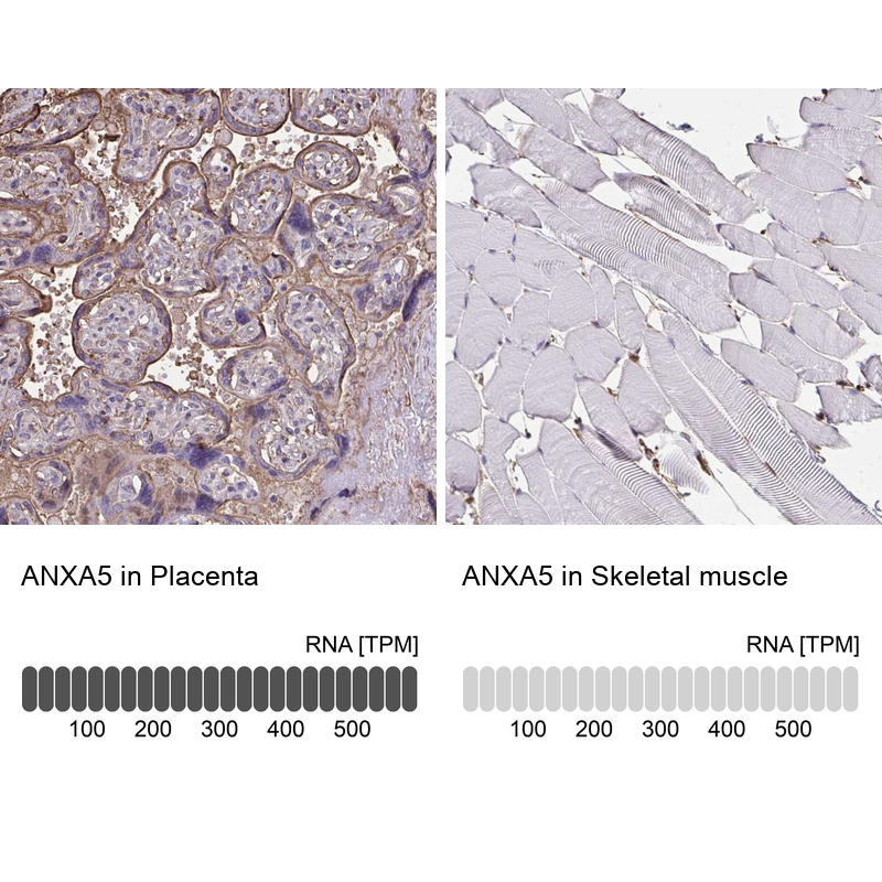 Anti-ANXA5 Antibody