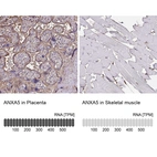 Anti-ANXA5 Antibody