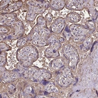 Immunohistochemical staining of human placenta shows moderate membranous positivity in trophoblastic cells.