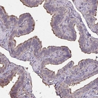Immunohistochemical staining of human fallopian tube shows moderate positivity in cilia in glandular cells.