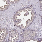Immunohistochemical staining of human prostate shows moderate membranous positivity in glandular cells.
