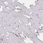 Immunohistochemical staining of human skeletal muscle shows low positivity in myocytes as expected.