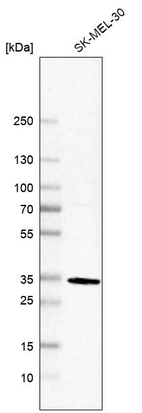 Western blot analysis in human cell line SK-MEL-30.