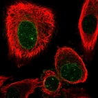 Immunofluorescent staining of human cell line PC-3 shows localization to nuclear membrane.