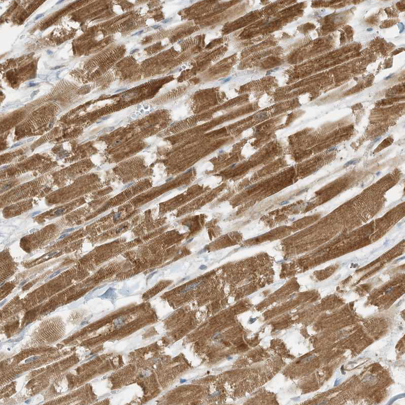 Anti-SLC25A12 Antibody