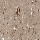 Immunohistochemical staining of human cerebral cortex shows strong cytoplasmic positivity in neurons.