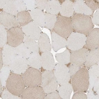 Immunohistochemical staining of human skeletal muscle shows weak cytoplasmic positivity in myocytes.