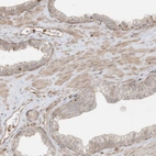 Immunohistochemical staining of human prostate shows weak cytoplasmic positivity in smooth muscle cells.
