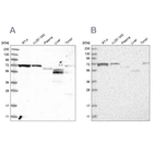 Western blot analysis using Anti-SLC25A12 antibody HPA035333 (A) shows similar pattern to independent antibody HPA035334 (B).