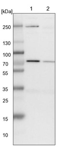 Anti-SLC25A12 Antibody