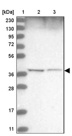 Lane 1: Marker [kDa] 230, 130, 95, 72, 56, 36, 28, 17, 11_br/_Lane 2: Human cell line RT-4_br/_Lane 3: Human cell line U-251MG sp