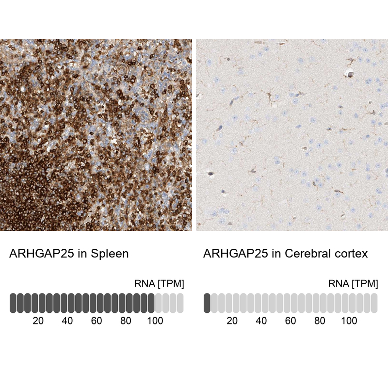 Anti-ARHGAP25 Antibody