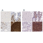 Immunohistochemical staining of human cerebral cortex, colon, kidney and lymph node using Anti-ARHGAP25 antibody HPA035346 (A) shows similar protein distribution across tissues to independent antibody HPA061395 (B).