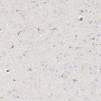 Immunohistochemical staining of human cerebral cortex shows low expression as expected.