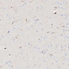 Immunohistochemical staining of human cerebral cortex shows low expression as expected.