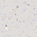 Immunohistochemical staining of human cerebral cortex using Anti-ARHGAP25 antibody HPA035346.