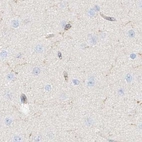 Immunohistochemical staining of human cerebral cortex using Anti-ARHGAP25 antibody HPA035346.