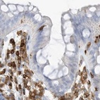 Immunohistochemical staining of human colon using Anti-ARHGAP25 antibody HPA035346.