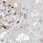 Immunohistochemical staining of human kidney using Anti-ARHGAP25 antibody HPA035346.