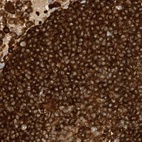 Immunohistochemical staining of human lymph node using Anti-ARHGAP25 antibody HPA035346.