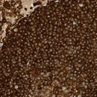 Immunohistochemical staining of human lymph node using Anti-ARHGAP25 antibody HPA035346.