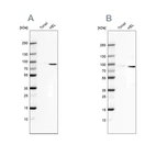 Western blot analysis using Anti-ARHGAP25 antibody HPA035346 (A) shows similar pattern to independent antibody HPA061395 (B).