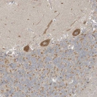 Anti-NPPC Antibody