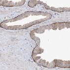 Immunohistochemical staining of human prostate shows moderate to strong cytoplasmic positivity in basal cells.