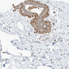Immunohistochemical staining of human breast shows moderate to strong cytoplasmic positivity in glandular cells.