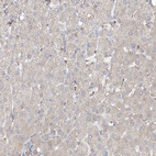 Immunohistochemical staining of human liver shows very weak cytoplasmic positivity in hepatocytes.