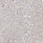 Immunohistochemical staining of human liver shows very weak cytoplasmic positivity in hepatocytes.