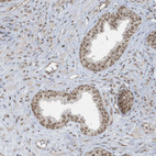 Immunohistochemical staining of human prostate shows moderate to strong nuclear positivity in glandular cells.