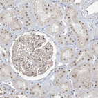 Immunohistochemical staining of human kidney shows moderate nuclear positivity in cells in tubules.