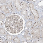 Immunohistochemical staining of human kidney shows moderate nuclear positivity in cells in tubules.