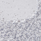 Immunohistochemical staining of human cerebellum shows weak nuclear positivity in Purkinje cells.