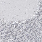Immunohistochemical staining of human cerebellum shows weak nuclear positivity in Purkinje cells.