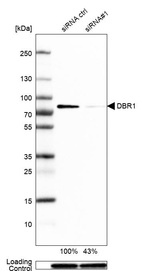Anti-DBR1 Antibody