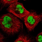Immunofluorescent staining of human cell line A-431 shows localization to nucleoplasm.
