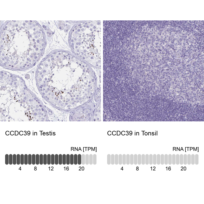 Anti-CCDC39 Antibody